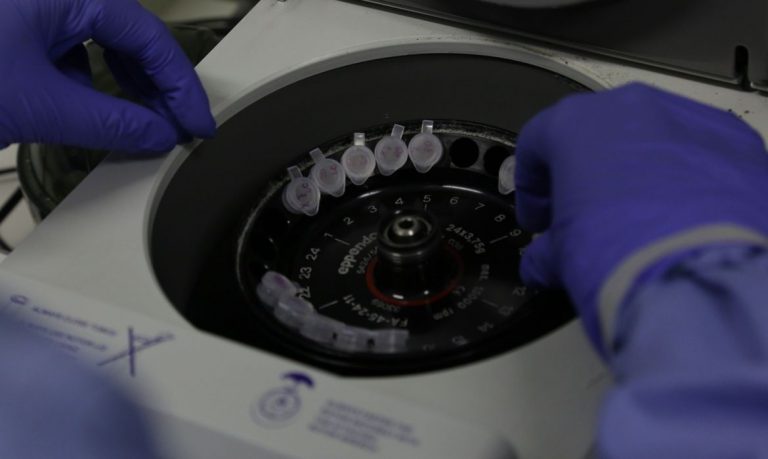 diagnostico_laboratorial_de_casos_suspeitos_do_novo_coronavirus_2801209408