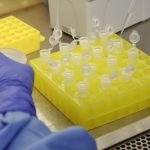 diagnostico_laboratorial_de_casos_suspeitos_do_novo_coronavirus_2801209411